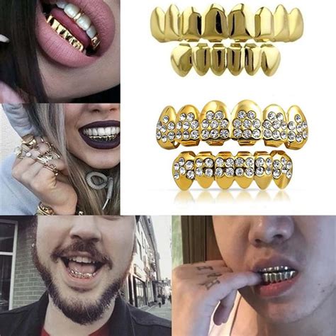 Hip hop altın diş